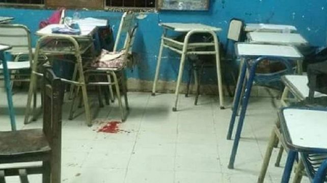 Llevó un arma a la escuela y le disparó en la cara a una compañera