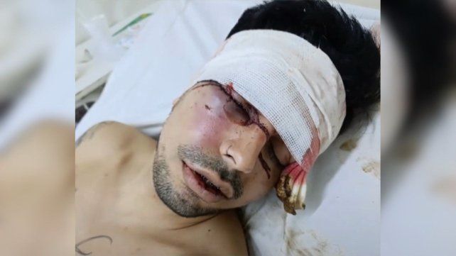Un muchacho fue salvajemente agredido tras una fiesta de graduación