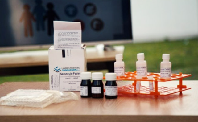 Desarrollaron un test de coronavirus que también funciona en animales