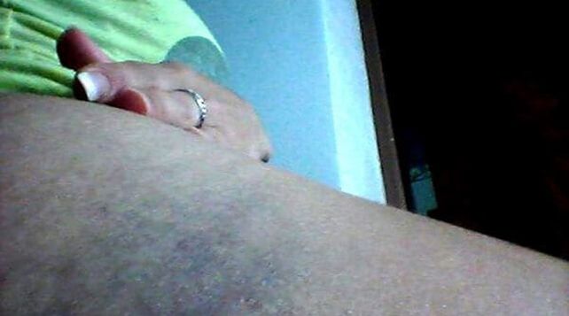 En medio del conflicto con el Polaco, aparecieron fotos de Valeria Aquino golpeada