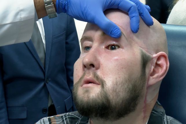 El doctor Eduardo Rodríguez comprueba el buen flujo sanguíneo y la falta de rechazo en el nuevo ojo de James.