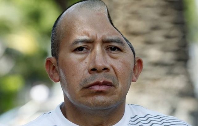 Antonio López Chaj recibió una paliza en 2010 que lo dejó sin una cuarta parte de su cabeza. (Foto:AP)
