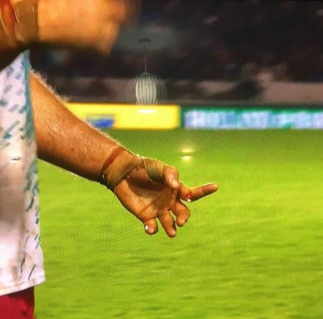 Rugby: escalofriante lesión de un jugador en una de sus manos