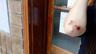 Paraná: una mujer atacó a una chica en la calle