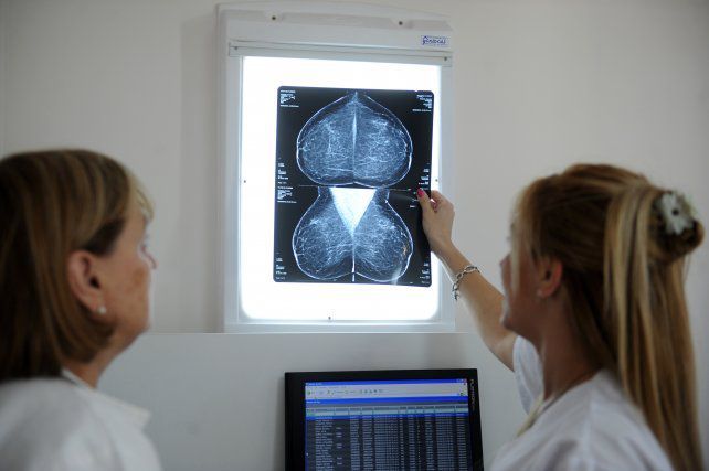 Los estudios realizados en forma anual ayudan a detectar el cáncer de mama en etapas muy incipientes 