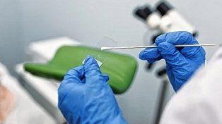 El agente causal del cáncer de cuello uterino es el Virus del Papiloma Humano (VPH). Desde la provincia refuerzan tareas de prevención