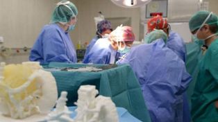 Aplicaron una inédita técnica 3D para extirpar un tumor a un niño de 11 años