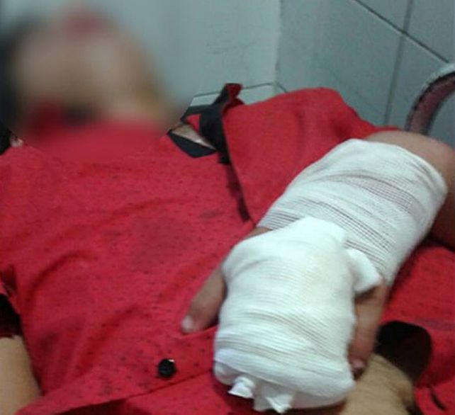 Por hacer el avioncito con su moto, perdió dos dedos de la mano