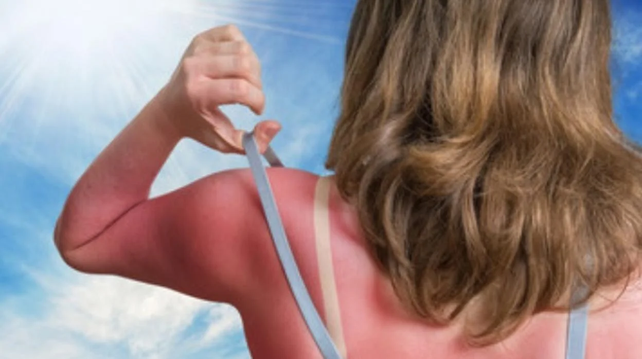 Las 7 consultas médicas más frecuentes del verano: consejos para cuidarte bajo el sol