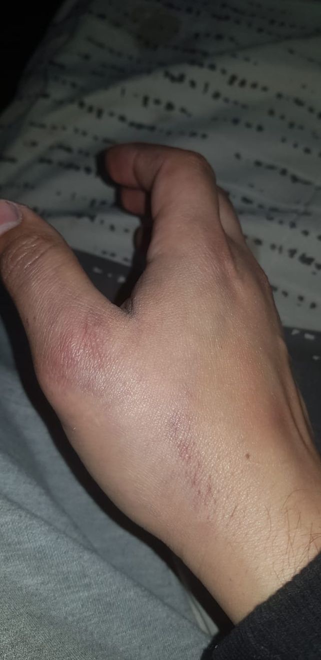 Cañada de Gómez: fue a denunciar una fiesta clandestina y terminó preso y malherido