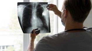 Desde la Fundación Alguien Como Yo FQ se expresó preocupación en relación a datos sobre casos de Fibrosis Quística de Entre Ríos tomadas del Boletín Epidemiológico Nacional&nbsp;