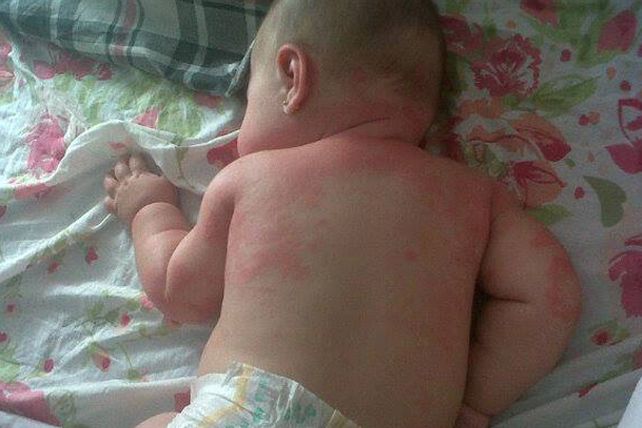 Denuncia por bebés que habrían sido afectados por conocido FPS