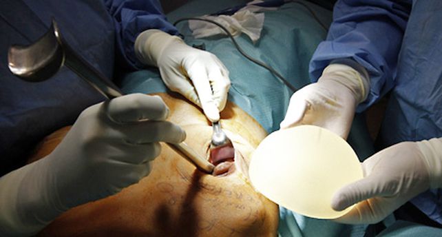 Alarma mundial por implantes mamarios franceses que estallan
