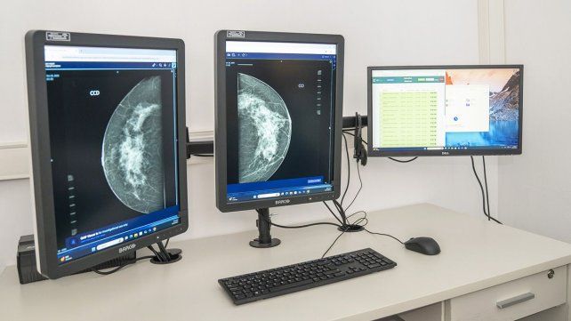 La Central de Informes de Mamografía Entre Ríos (CIMaER)