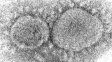 Imagen de microscopio electrónico de 2020 muestra partículas de virus SARS-CoV-2, que causa Covid19.