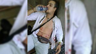 Quién es el fotógrafo que recibió diez impactos de balas de goma