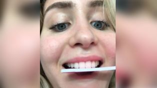 El nuevo reto viral de Tik Tok que puso en alerta a los odontólogos