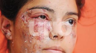 “No hay forma de detectar un artefacto explosivo casero”