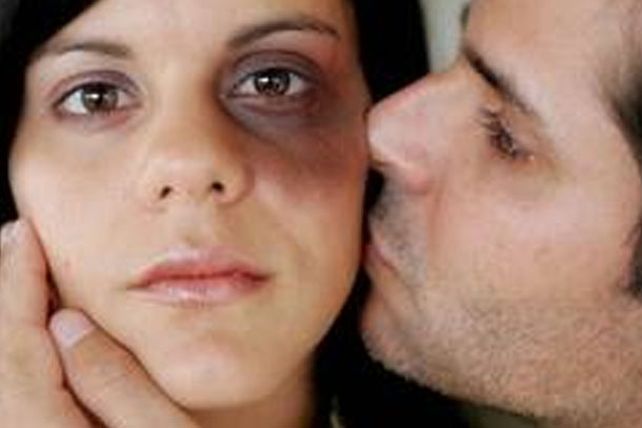 Se abrió el debate: tras los episodios de mujeres quemadas, dicen que no se cumple la ley de violencia