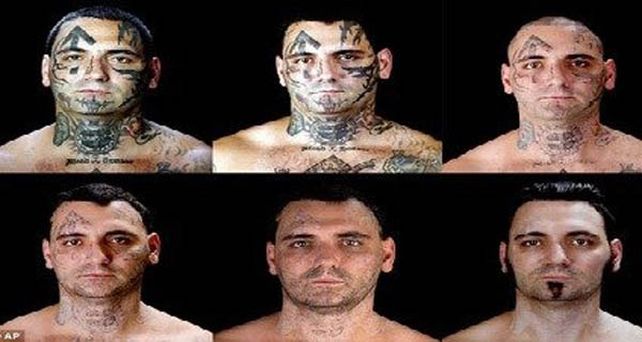 Un racista se someti&oacute; a dolorosas cirug&iacute;as para quitarse los tatuajes