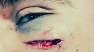 Brutal golpiza a un preceptor acusado de acosar a una alumna