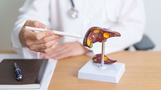 Trasplante hepático: el procedimiento de alta complejidad que restaura las funciones vitales