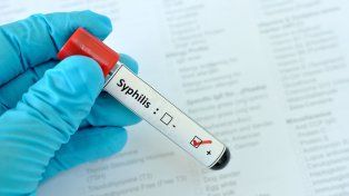 La infección de transmisión sexual (ITS) sífilis, no para de crecer en Argentina