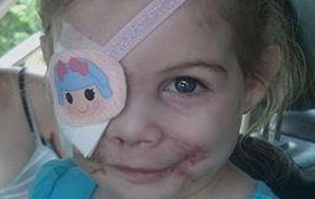 Victoria Wilcher. La niña de tres años fue atacada por tres perros pitbull. Y ahora la discriminaron en un local KFC.