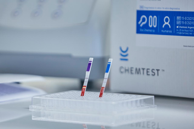 Científicos argentinos desarrollaron nuevo kit diagnóstico de covid-19 más rápido y simple