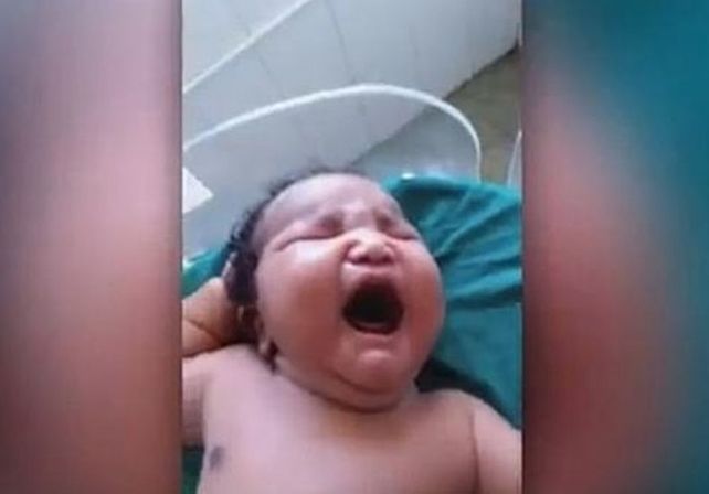 El bebé más grande del mundo nació en la India con 7 kilos de peso y por cesárea