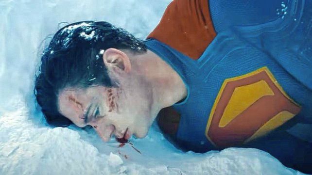 Superman: esta nueva versión muestra al Hombre de Acero más humano, hasta sangra