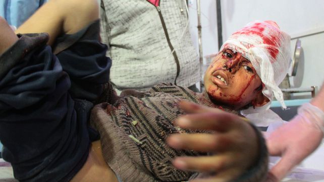 Criminal. Uno de los chicos heridos por las bombas del régimen sirio