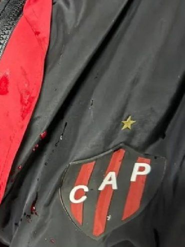 Rompió el silencio uno de los jugadores de Patronato atacado por la barra: Me dieron con la culata de un arma