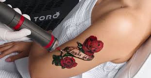 Mucho más que estética: cómo borrar tatuajes, y el ranking de los arrepentidos