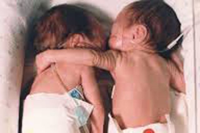 El abrazo de una gemela prematura a su hermana que le salvo la vida
