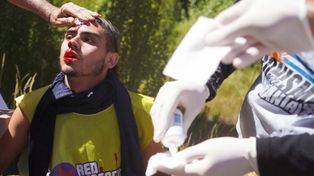 Uno de los manifestantes exhibe una herida producto de las agresiones deunciadas.