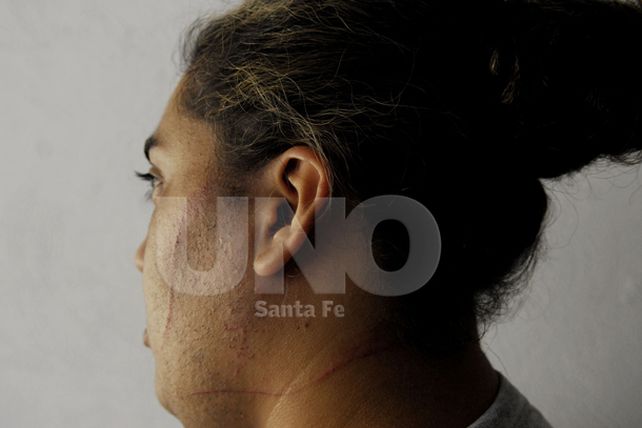 Una policía resistió un asalto, hirió al ladrón y salvó su vida