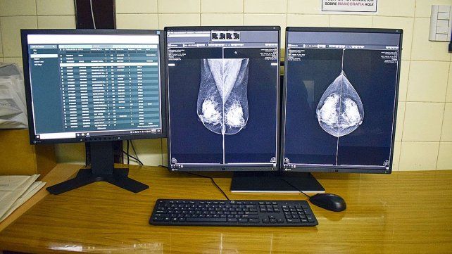 El hospital San Martín de Paraná incorporó equipo para informar mamografías. Consta de dos monitores de alta resolución y pc con capacidad de almacenamiento&nbsp;