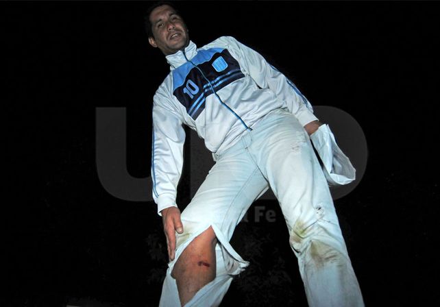 Herido. El agente lesionado es el cabo César Budiño