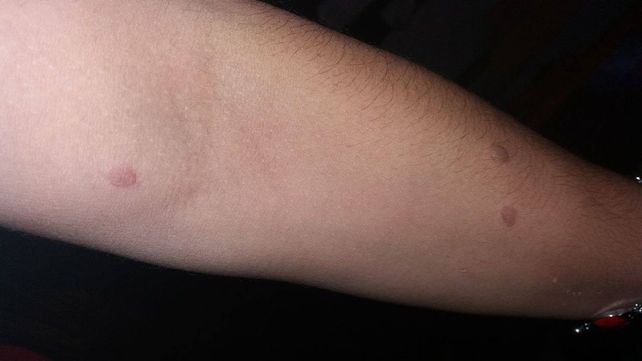 Golpes y quemaduras.&nbsp;Las fotos demuestran el rastro de la violencia en la boca y brazo de la víctima.