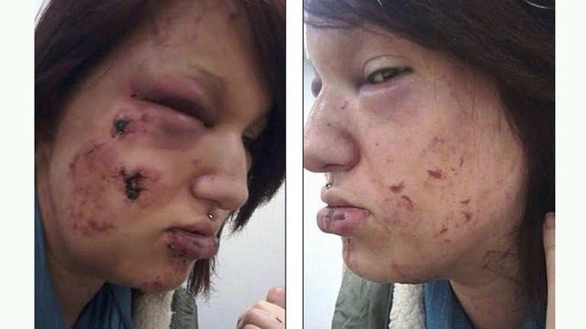 El joven la mordió en la cara y las manos.