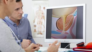Es muy importante que los hombres hagan una consulta anual con el especialista en próstata&nbsp;