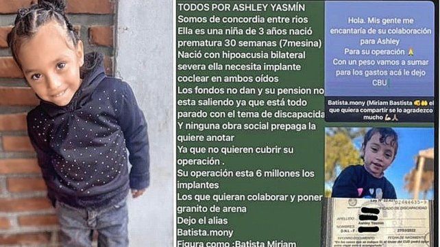 Colecta solidaria para que una niña de Concordia pueda acceder a implantes cocleares.