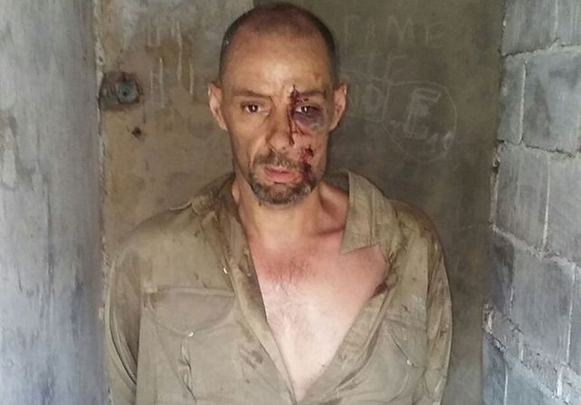 La foto de martín Lanatta tras ser detenido. COn golpes por el vuelco producido por el accidente sobre la ruta n1.