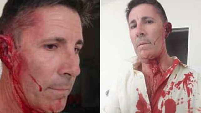 Un municipal golpeó al director de la Unidad N° 2