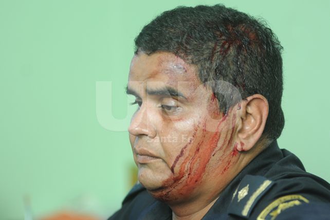 Hirieron de un piedrazo al jefe del Comando Radioeléctrico santafesino