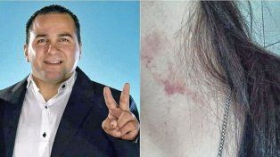 Concordia: malestar por el regreso del ex viceintendente denunciado por violencia de género.