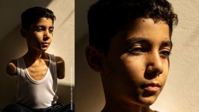 Un niño palestino mutilado por los bombardeos de Israel sobre Gaza, mejor foto del año en los World Press Photo 2025