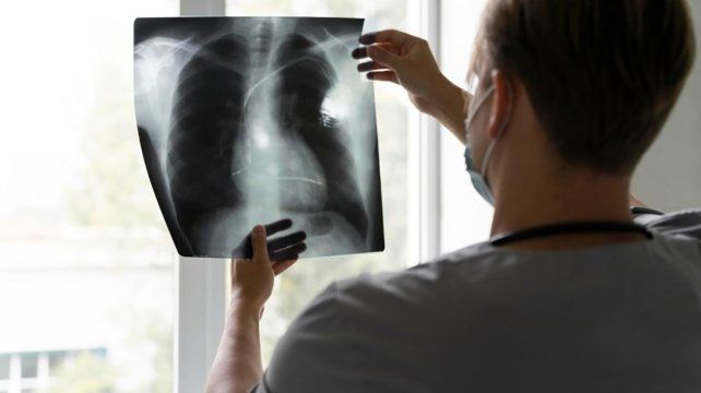 Desde la Fundación Alguien Como Yo FQ se expresó preocupación en relación a datos sobre casos de Fibrosis Quística de Entre Ríos tomadas del Boletín Epidemiológico Nacional&nbsp;
