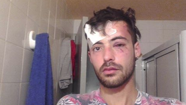 Fue salvajemente golpeado por dar a conocer su orientación sexual